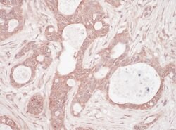 Sequestosome-1 Rabbit anti-Human, Mouse, Polyclonal, Bethyl Laboratories