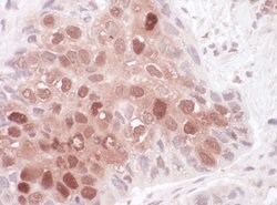Sequestosome-1 Rabbit anti-Human, Polyclonal, Bethyl Laboratories 100 &mu;l;