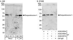 Sequestosome-1 Rabbit anti-Human, Mouse, Polyclonal, Bethyl Laboratories