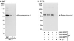 Sequestosome-1 Rabbit anti-Human, Polyclonal, Bethyl Laboratories 100 &mu;l;