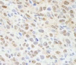 Sin1 Polyclonal Antibody, Bethyl Laboratories:Antibodies:Primary Antibodies