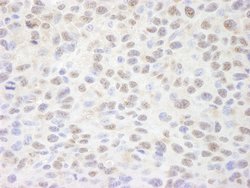 Sin3A Polyclonal Antibody, Bethyl Laboratories 10 &mu;L; Unconjugated:Antibodies,