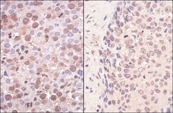 SmcHD1 Rabbit anti-Human, Polyclonal, Bethyl Laboratories 100 &mu;l; Unlabeled:Antibodies,