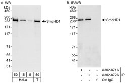 SmcHD1 Rabbit anti-Human, Polyclonal, Bethyl Laboratories 100 &mu;l; Unlabeled:Antibodies,