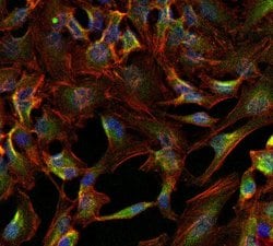ATP1A1 Monoclonal Antibody (M8-P1-A3), Invitrogen 100 &mu;g; Unconjugated:Antibodies,