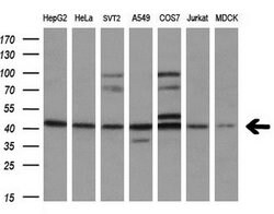 Sox17 Mouse anti-Human, Clone: OTI3B10, lyophilized, TrueMAB 100 &mu;g;