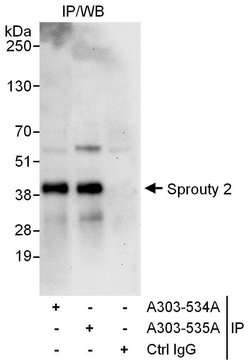 Sprouty 2 Rabbit anti-Human, Polyclonal, Bethyl Laboratories 100 &mu;l;
