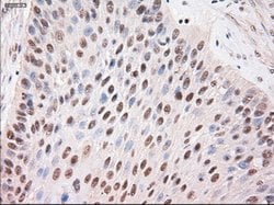 Stat4 Mouse anti-Human, Clone: OTI2A2, lyophilized, TrueMAB 100 &mu;g;