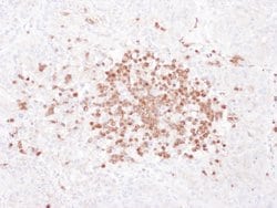 Stomatin Rabbit anti-Human, Polyclonal, Bethyl Laboratories 100 &mu;l;