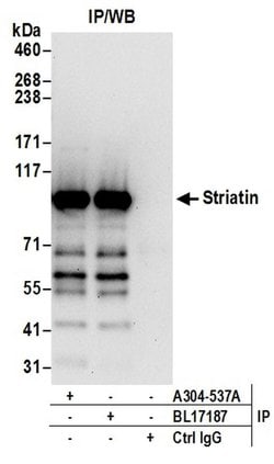 Striatin Rabbit anti-Human, Mouse, Polyclonal, Bethyl Laboratories 100 &mu;L | Buy Online | Bethyl Laboratories, Inc | Fisher Scientific