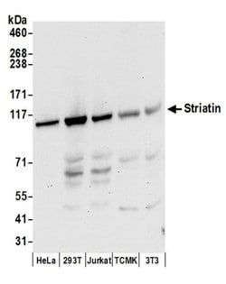 Striatin Rabbit anti-Human, Mouse, Polyclonal, Bethyl Laboratories 100 &mu;L | Buy Online | Bethyl Laboratories, Inc | Fisher Scientific