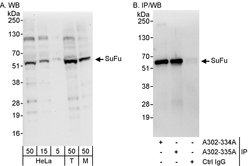 SuFu Rabbit anti-Human, Mouse, Polyclonal, Bethyl Laboratories 100 &mu;l;