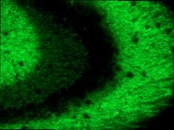 Invitrogen SynGAP Polyclonal Antibody 100 &mu;g; Unconjugated:Antibodies,