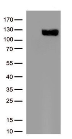 ACE2 Monoclonal Antibody (OTI3C2), TrueMAB , OriGene 30 &mu;L; Unconjugated:Anticorps,