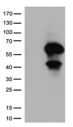 CD27 Monoclonal Antibody (OTI4D11), TrueMAB , OriGene:Antibodies:Primary