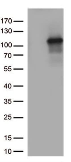 TUBGCP3 Monoclonal Antibody (OTI2A1), TrueMAB , OriGene 30 &mu;L; Unconjugated:Anticorps,