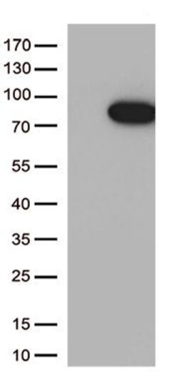 MASP2 Monoclonal Antibody (OTI7C4), TrueMAB , OriGene 100 &mu;L; Unconjugated:Antibodies,