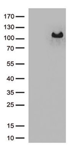 ARHGEF4 Monoclonal Antibody (OTI1A6), TrueMAB , OriGene 30 &mu;L | Buy Online | Origene Technologies | Fisher Scientific