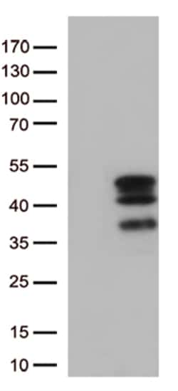 VGLL3 Monoclonal Antibody (OTI1D8), OriGene 30 &mu;L; Unconjugated:Anticuerpos