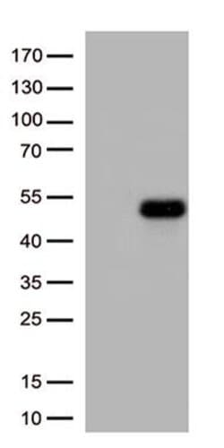 ATF4 Monoclonal Antibody (OTI1H9), TrueMAB , OriGene:Antibodies:Primary