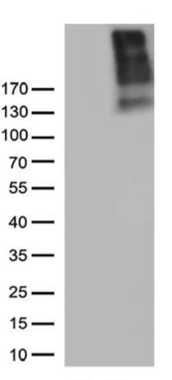 CSPG4 Monoclonal Antibody (OTI3C12), TrueMAB , OriGene 30 &mu;L; Unconjugated:Antibodies,