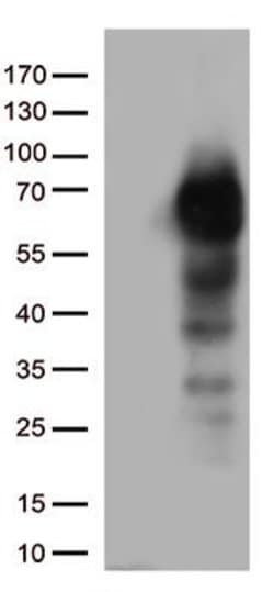 NGFR Monoclonal Antibody (OTI8F1), TrueMAB , OriGene 30 &mu;L; Unconjugated:Antibodies,