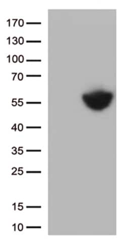PD L1 (CD274) Monoclonal Antibody (OTI14H4), OriGene 30 &mu;L; Unconjugated:Antibodies