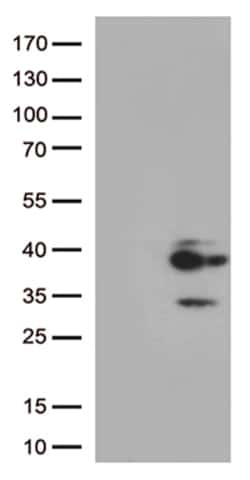 Major Basic Protein (PRG2) Monoclonal Antibody (OTI10D10), OriGene 30 &mu;L;