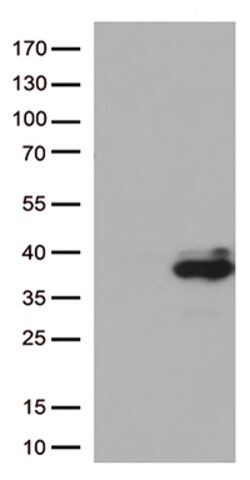 Major Basic Protein (PRG2) Monoclonal Antibody (OTI1C12), OriGene 30 &mu;L;