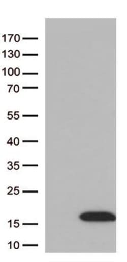 DBI Monoclonal Antibody (OTI4A8), TrueMAB , OriGene 30 &mu;L; Unconjugated:Anticuerpos