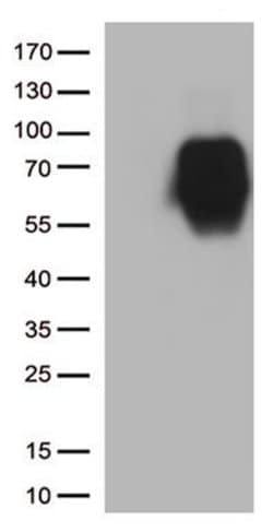 CD86 Monoclonal Antibody (OTI3B10), TrueMAB , OriGene 30 &mu;L; Unconjugated:Anticuerpos