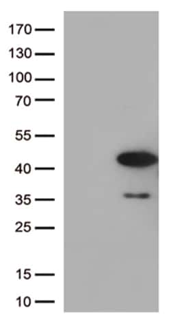 AMPK beta 1 (PRKAB1) Monoclonal Antibody (OTI3B11), OriGene 30 &mu;L; Unconjugated:Antibodies,
