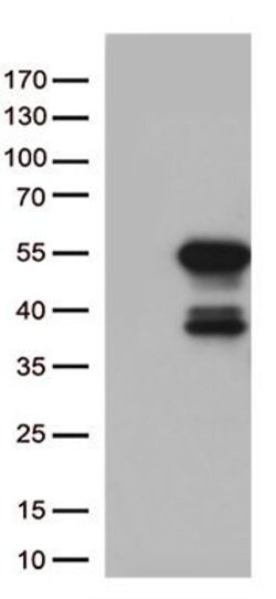 MTRF1 Monoclonal Antibody (OTI5D6), TrueMAB , OriGene:Antibodies:Primary