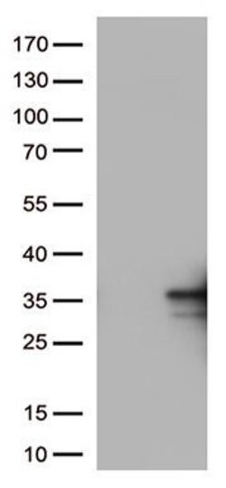 CD137L Monoclonal Antibody (OTI15C9), TrueMAB , OriGene 30 &mu;L; Unconjugated:Anticuerpos
