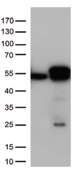 Calreticulin (CALR) Monoclonal Antibody (OTI13E4), OriGene 30 &mu;L; Unconjugated:Antibodies,