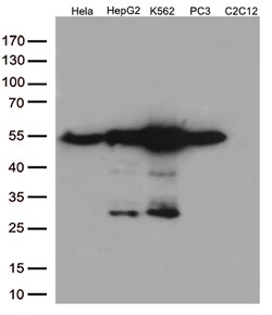 Calreticulin (CALR) Monoclonal Antibody (OTI13E4), OriGene 30 &mu;L; Unconjugated:Antibodies,
