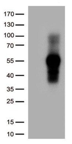 TNFRSF14 Monoclonal Antibody (OTI6E9), TrueMAB , OriGene 30 &mu;L; Unconjugated:Antibodies,