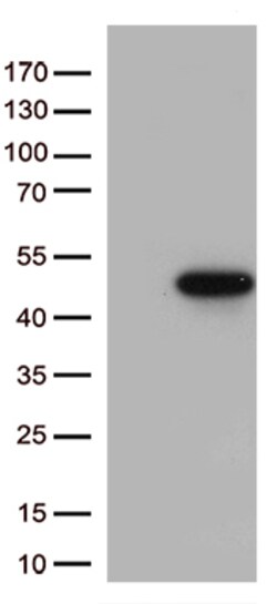 p38 (MAPK14) Monoclonal Antibody (OTI3F8), OriGene 30 &mu;L; Unconjugated:Antibodies,