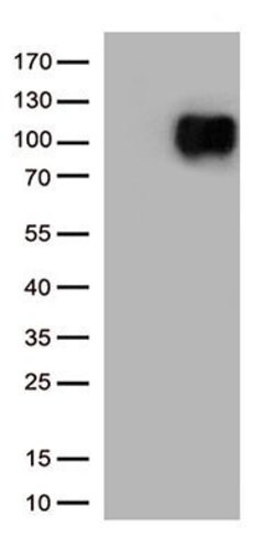 CD276 Monoclonal Antibody (OTI1A10), TrueMAB , OriGene 100 &mu;L; Unconjugated:Antibodies,