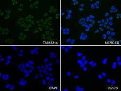 KAP1 (TRIM28) Monoclonal Antibody (OTI2H10), OriGene 30 &mu;L; Unconjugated:Anticuerpos