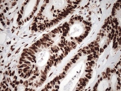 KAP1 (TRIM28) Monoclonal Antibody (OTI2H10), OriGene 30 &mu;L; Unconjugated:Anticuerpos