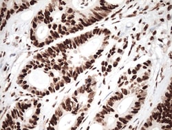 KAP1 (TRIM28) Monoclonal Antibody (OTI5E10), OriGene 30 &mu;L | Buy Online | Origene Technologies | Fisher Scientific