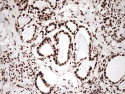 KAP1 (TRIM28) Monoclonal Antibody (OTI5E10), OriGene 30 &mu;L | Buy Online | Origene Technologies | Fisher Scientific