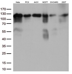 KAP1 (TRIM28) Monoclonal Antibody (OTI5E10), OriGene 30 &mu;L | Buy Online | Origene Technologies | Fisher Scientific
