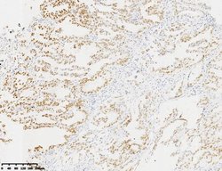 TTF1 Monoclonal Antibody (OTI7E8), TrueMAB , OriGene:Antibodies:Primary
