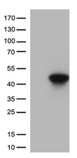 HLAA (HLA-A) Monoclonal Antibody (OTI4D11), TrueMAB , OriGene:Anticorps:Anticorps