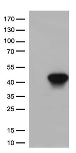 HLAA (HLA-A) Monoclonal Antibody (OTI2D11), TrueMAB , OriGene 100 &mu;L | Buy Online | Origene Technologies | Fisher Scientific