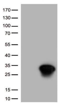 HSPB1 Monoclonal Antibody (OTI8D6), TrueMAB , OriGene 100 &mu;L; Unconjugated:Antibodies,