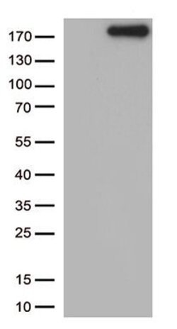 NPHS1 Monoclonal Antibody (OTI12D7), TrueMAB , OriGene 100 &mu;L; Unconjugated:Antibodies,