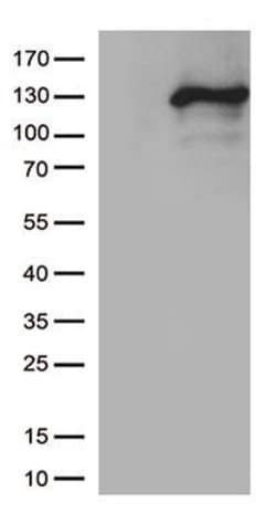 NOS2 Monoclonal Antibody (OTI11H3), TrueMAB , OriGene:Antibodies:Primary